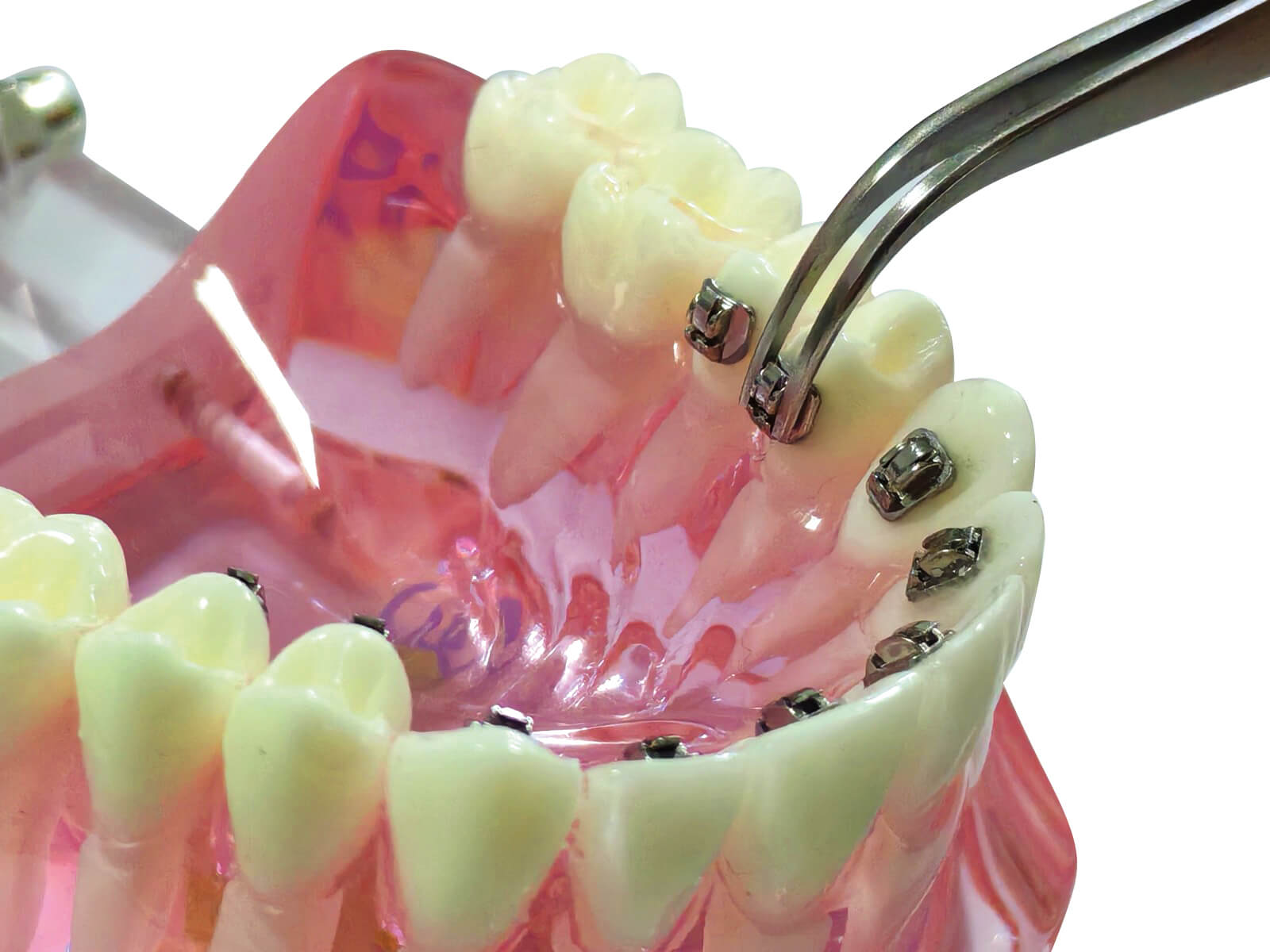 Aplos - Mini-Lingual Tube, 2 mm, 0.017" x 0.019"