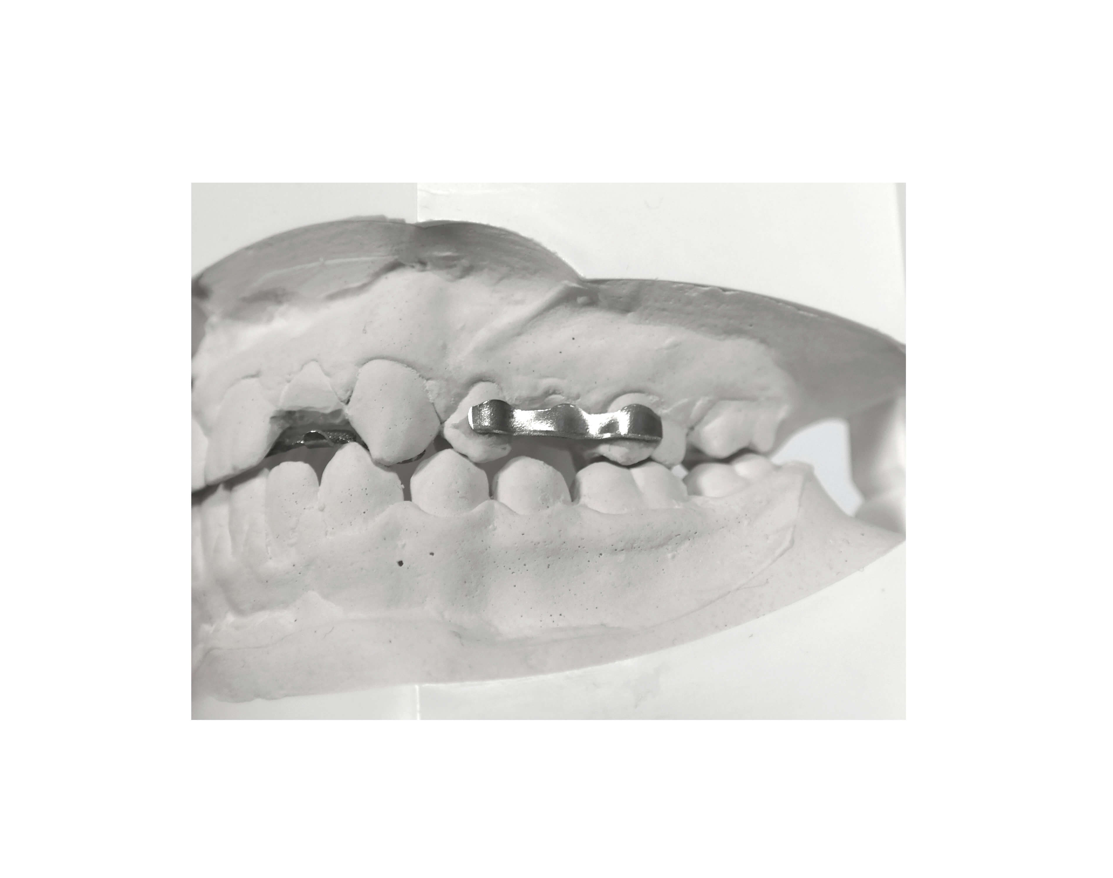 Netzbasis-Retainer