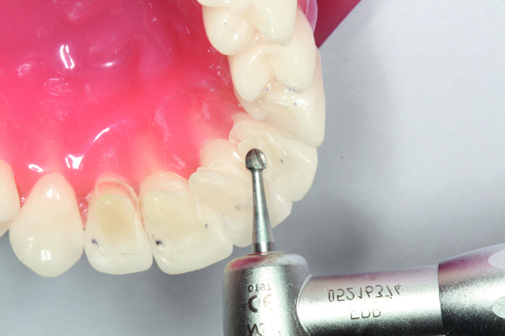 Tiger Mini Mold (mit Orthohalter)