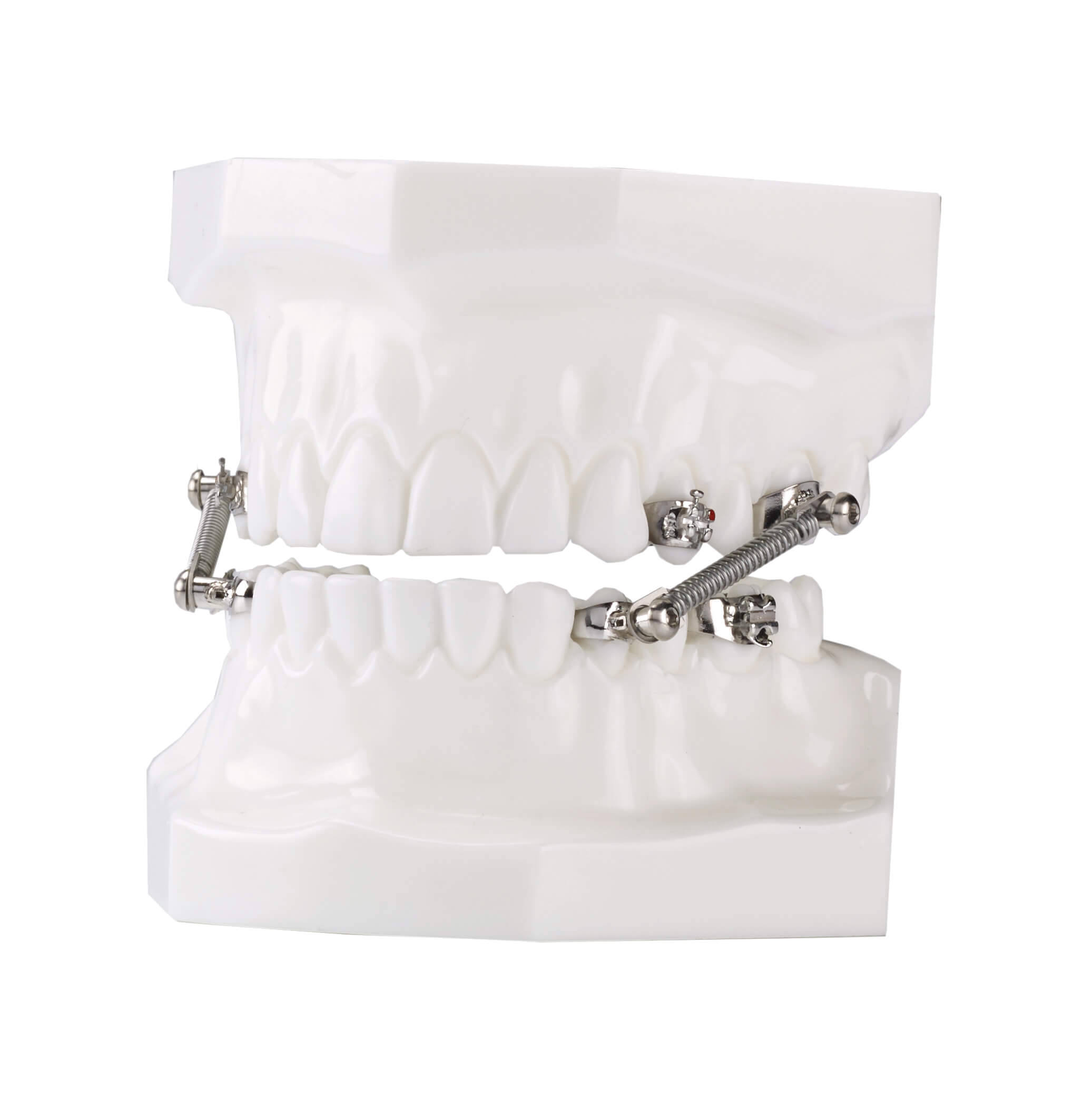 CS5 Twist Lock, 5-Patienten Kit (10 mm)