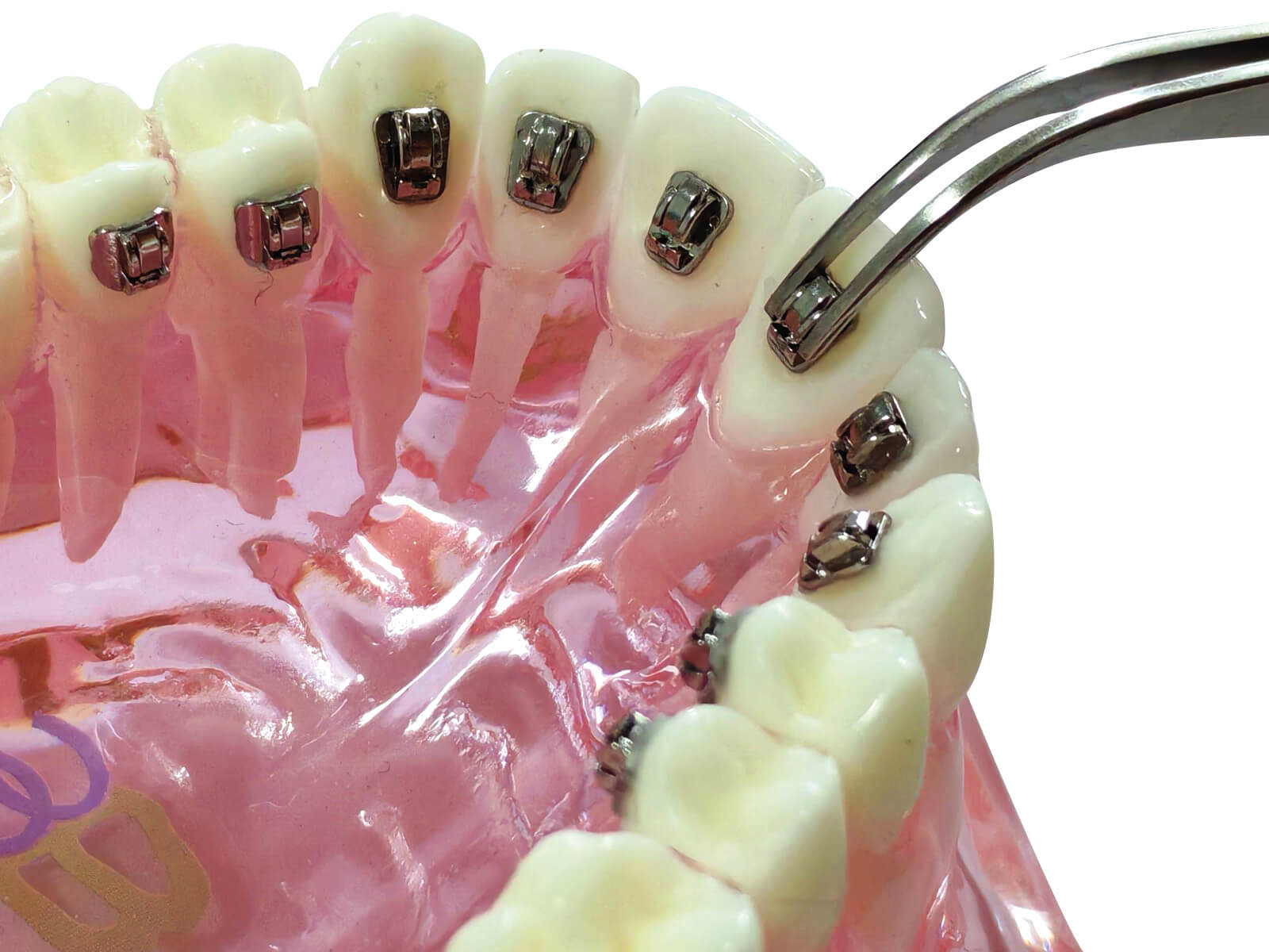 Aplos - Mini-Lingual Tube, 2 mm, 0.017" x 0.019"