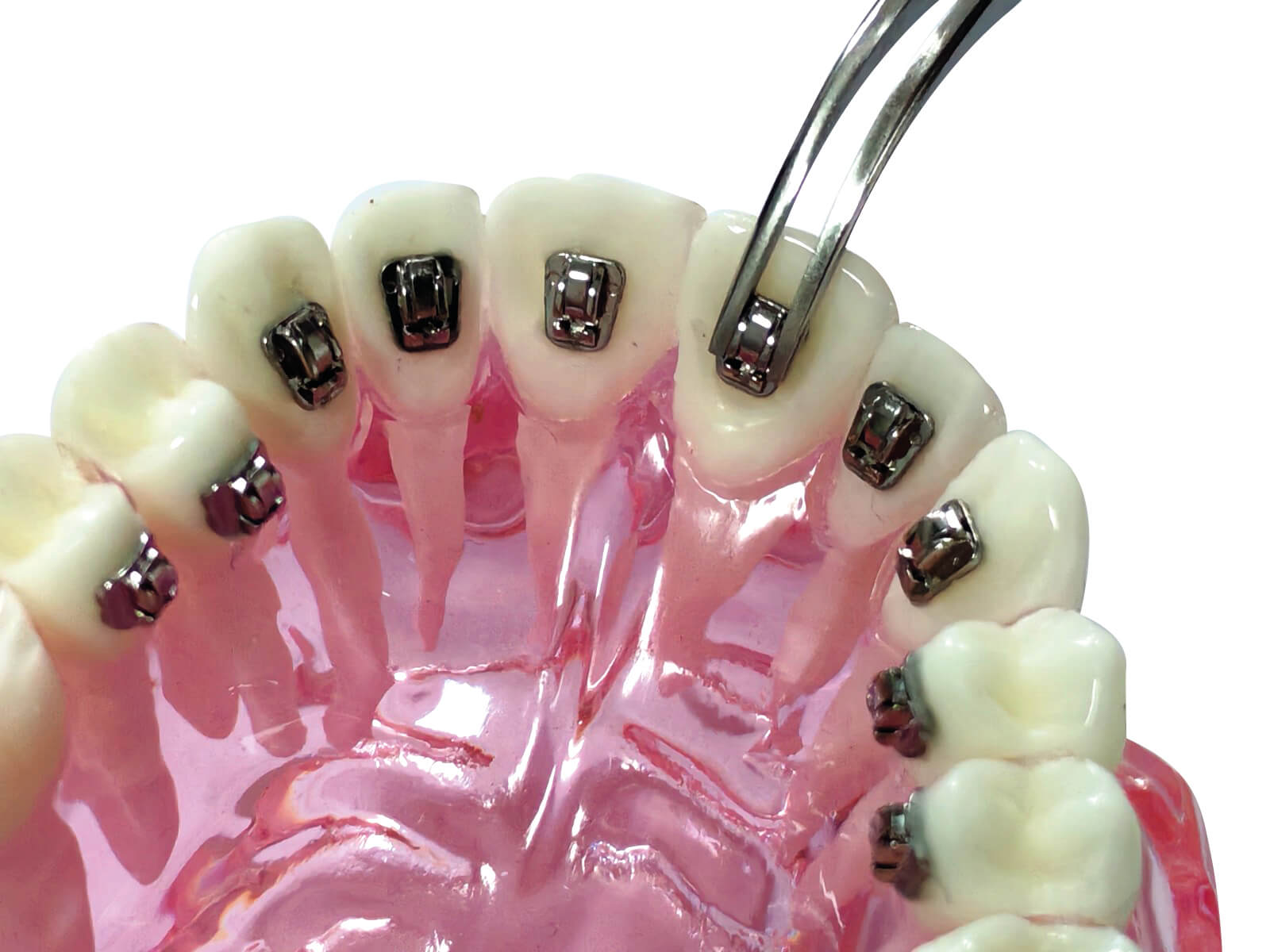 Aplos - Mini-Lingual Tube, 2 mm, 0.017" x 0.019"